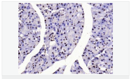 60544df21e3fe.png image.png