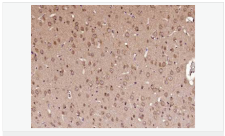 60584c8f72430.png image.png