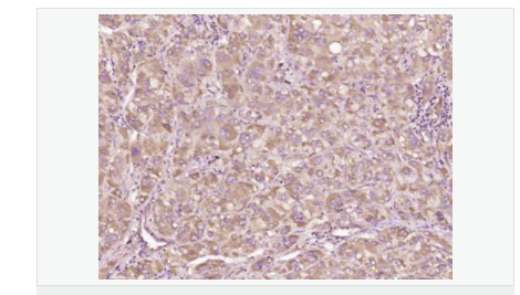 605da18e77d2d.png image.png