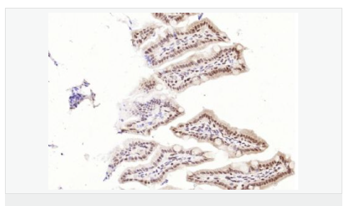 6066bc5fd105a.png image.png