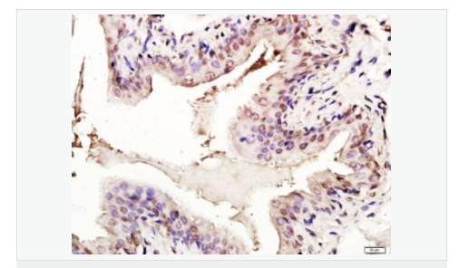 6066bcb2f3a14.png image.png