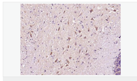 606bcfd06851e.png image.png