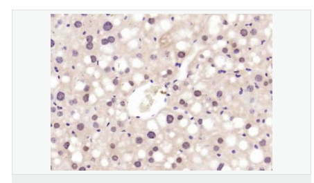 606bd49a3de94.png image.png