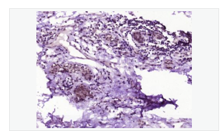 607658918c9bb.png image.png